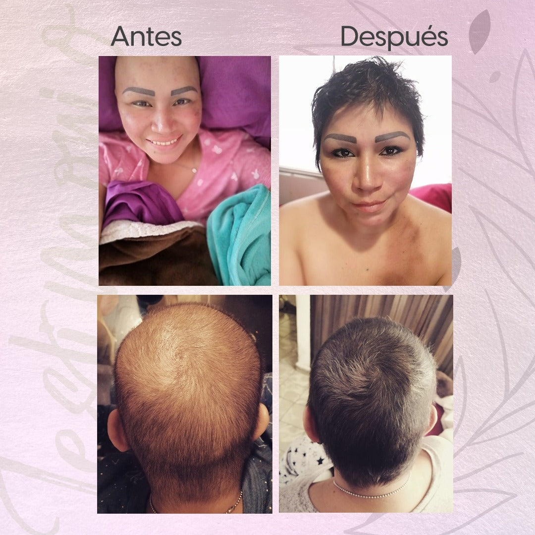 Kit Shampoo Anticaída Dama | Fortificante Rapunzel – Loción + Shampoo