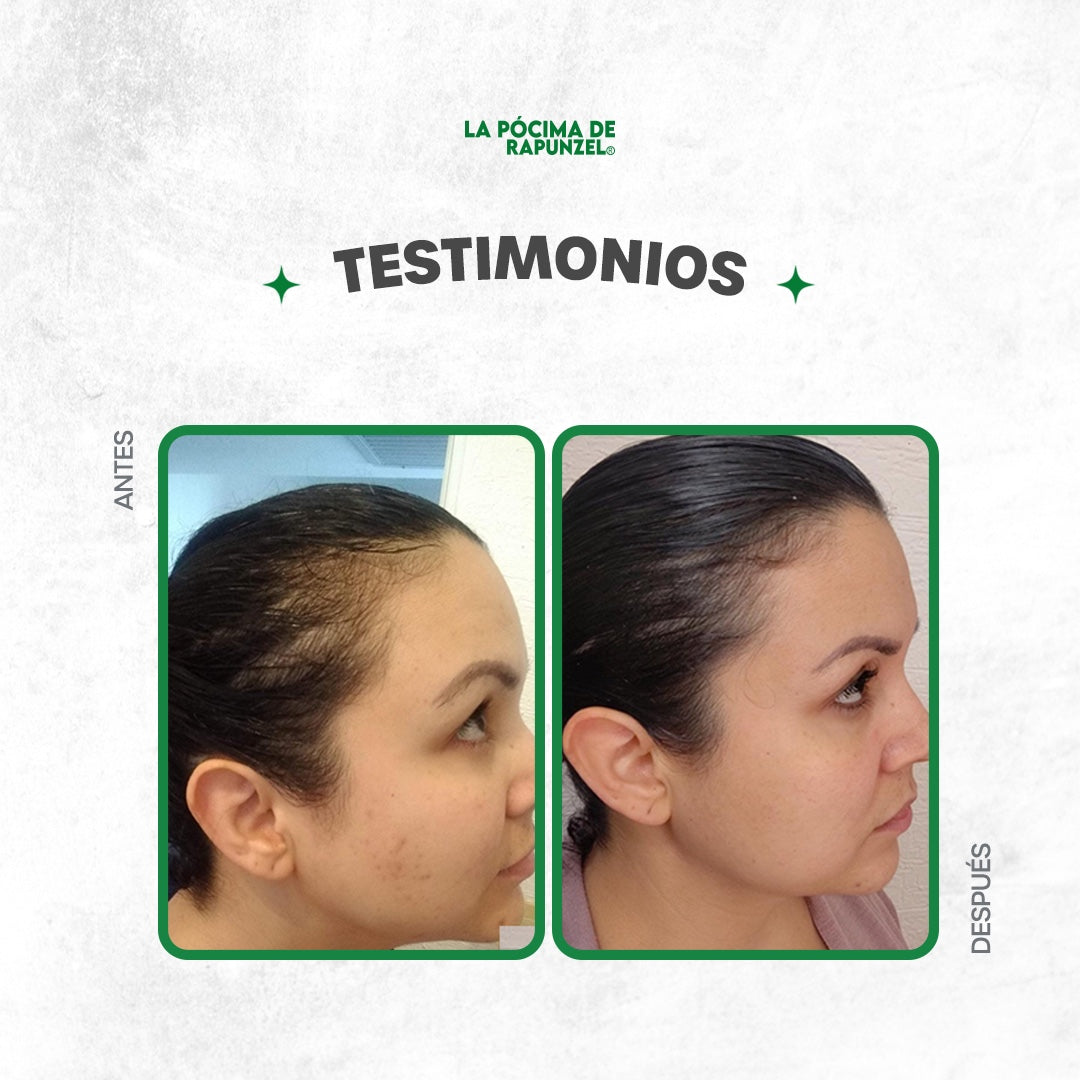Kit Shampoo Anticaída Dama | Fortificante Rapunzel – Loción + Shampoo