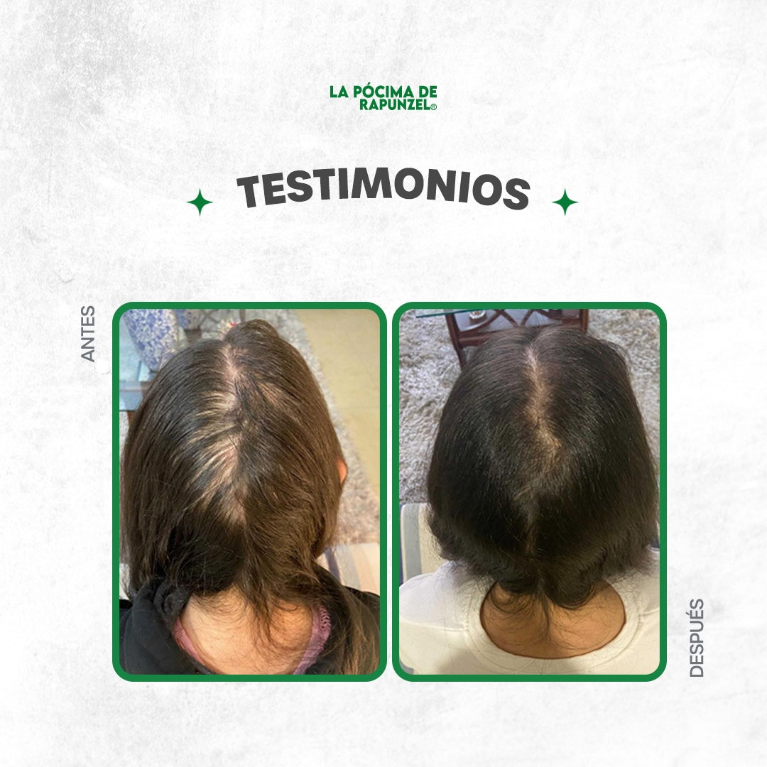 Kit Shampoo Anticaída Dama | Fortificante Rapunzel – Loción + Shampoo