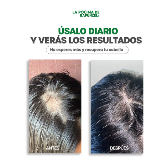 Kit Shampoo Anticaída Dama | Fortificante Rapunzel – Loción + Shampoo